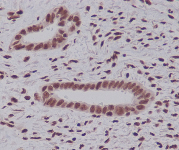 K48-linkage Specific Ubiquitin Rabbit mAb