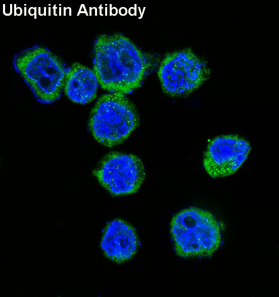 Ubiquitin Rabbit mAb