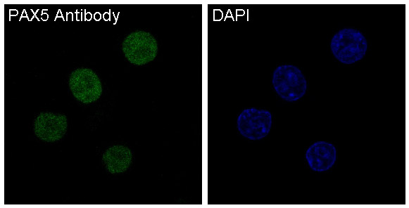 PAX5 Rabbit mAb