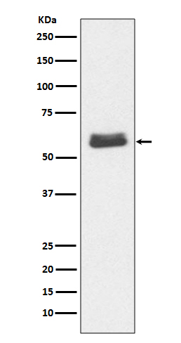 Caspase-10 Rabbit mAb