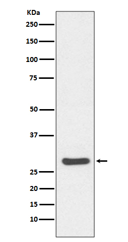 Caspase-14 Rabbit mAb