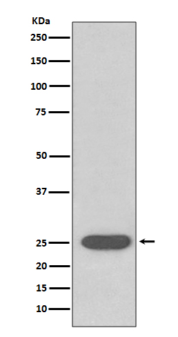 SOD2 Rabbit mAb