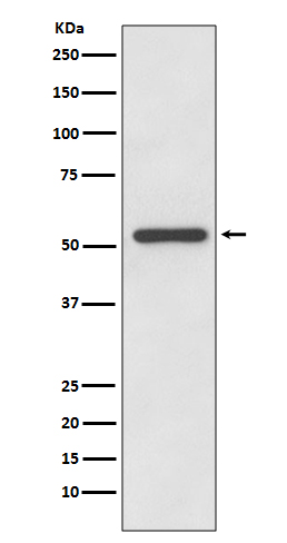 MMP13 Rabbit mAb