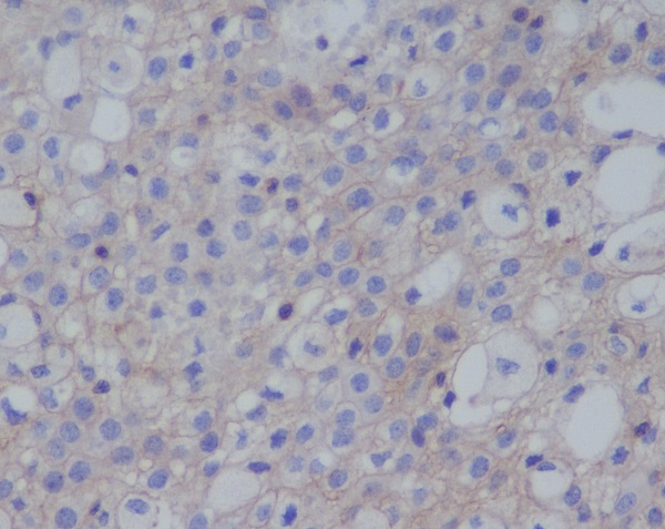 PD-L1 (CD274) Rabbit mAb