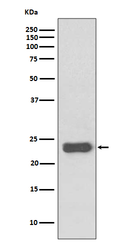 MGMT Rabbit mAb