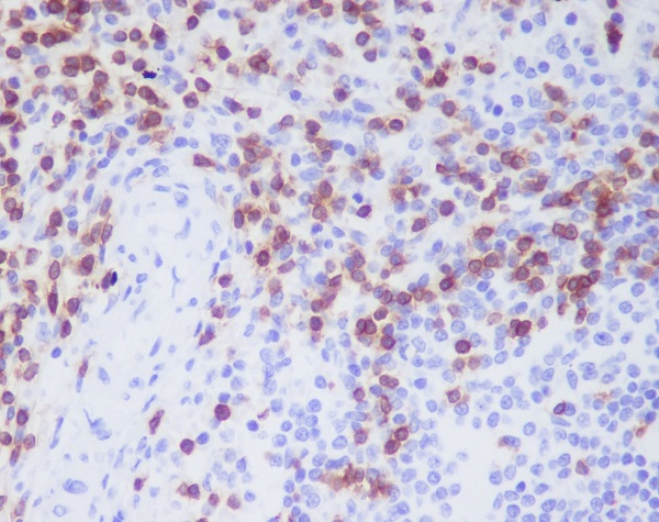 CD3D Rabbit mAb