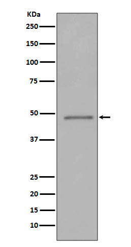 FOXP3 Rabbit mAb