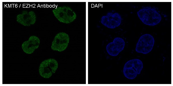 KMT6 / EZH2 Rabbit mAb