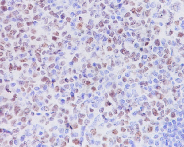 KMT6 / EZH2 Rabbit mAb