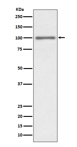 KMT6 / EZH2 Rabbit mAb