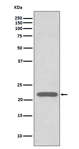 Peroxiredoxin 2 Rabbit mAb