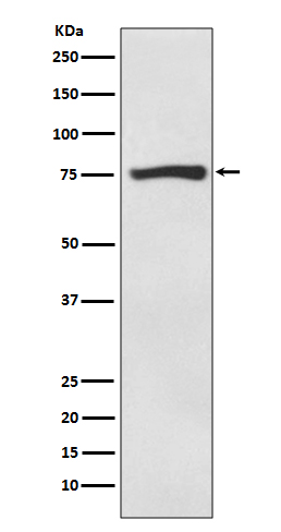 ACSS2 Rabbit mAb