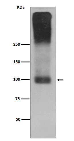 mGluR2 Rabbit mAb