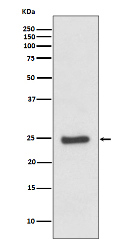 ZNRF2 Rabbit mAb