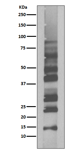 K63-linkage Specific Ubiquitin Rabbit mAb