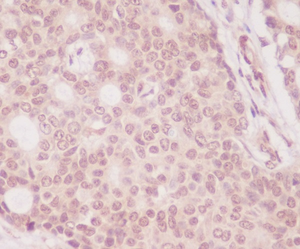 eIF4EBP1 Rabbit mAb