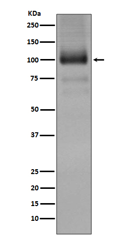 mGluR1 Rabbit mAb