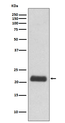 GPX1 Rabbit mAb