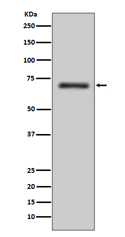 FUS / TLS Rabbit mAb