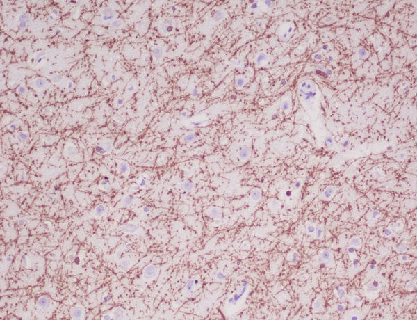 Myelin Basic Protein Rabbit mAb