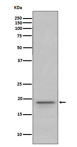 Myelin Basic Protein Rabbit mAb