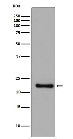 GPX1 Rabbit mAb