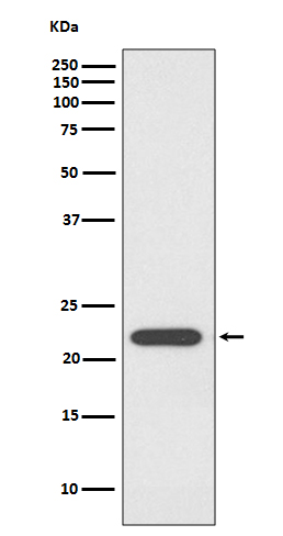 PRDX1 Rabbit mAb 
