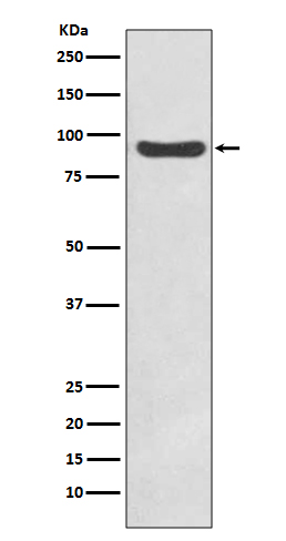 IKK beta Rabbit mAb