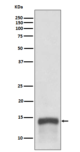 S100A9 Rabbit mAb