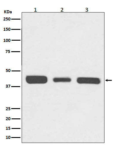 67kDa Laminin Receptor Rabbit mAb