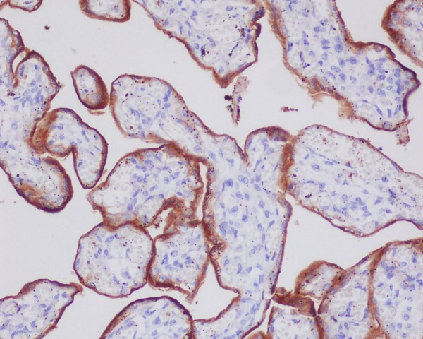 Transferrin Receptor (CD71) Rabbit mAb