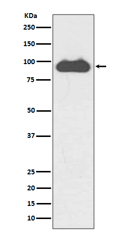 Transferrin Receptor (CD71) Rabbit mAb