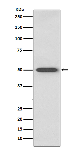 RAGE Rabbit mAb