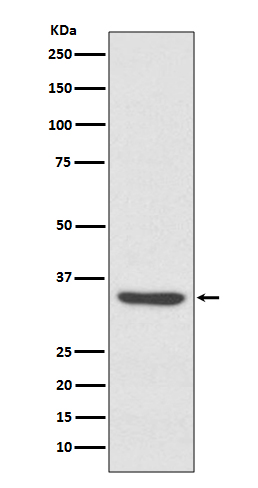 LYVE1 Rabbit mAb