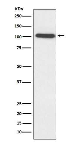 ACTN2 Rabbit mAb