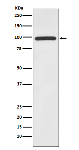 HMGCR Rabbit mAb