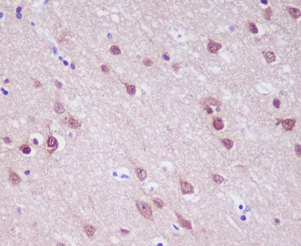 PGP9.5 Rabbit mAb