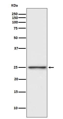 PGP9.5 Rabbit mAb