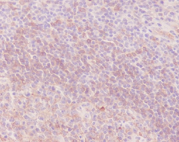 Human IgM Rabbit mAb