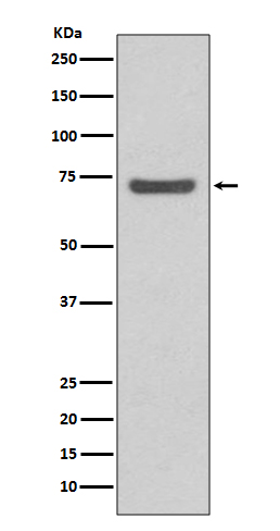 ABCG2 Rabbit mAb