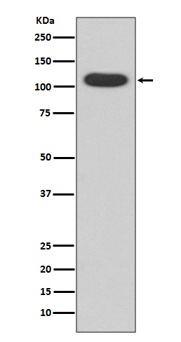 AhR Rabbit mAb
