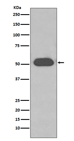 GC / VDBP Rabbit mAb