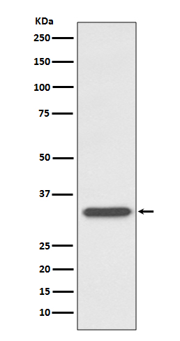 CD74 Rabbit mAb