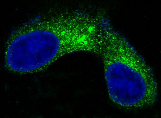 CEA(CD66e) Rabbit mAb