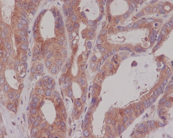 CEA(CD66e) Rabbit mAb