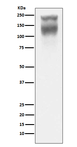 CEA(CD66e) Rabbit mAb