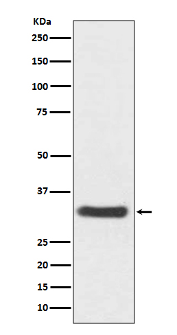 NQO1 Rabbit mAb