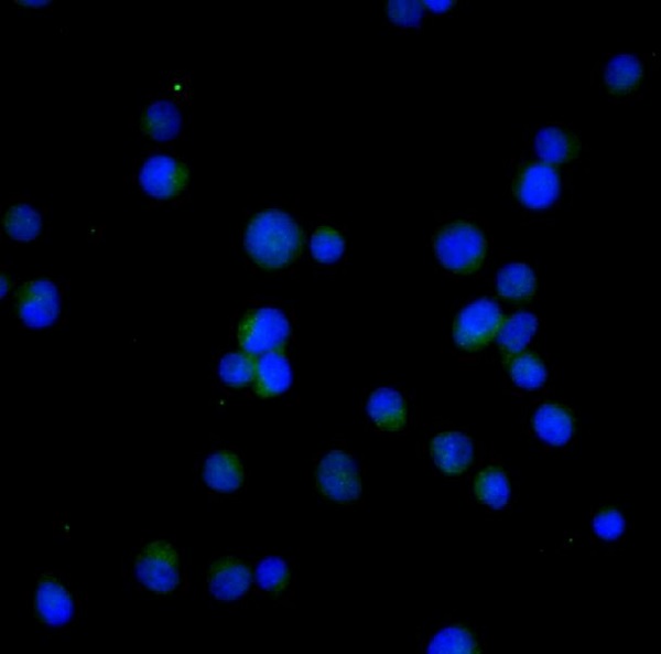 Bcl-2 Rabbit mAb