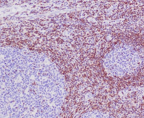 Bcl-2 Rabbit mAb