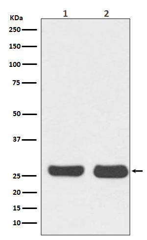 Bcl-2 Rabbit mAb